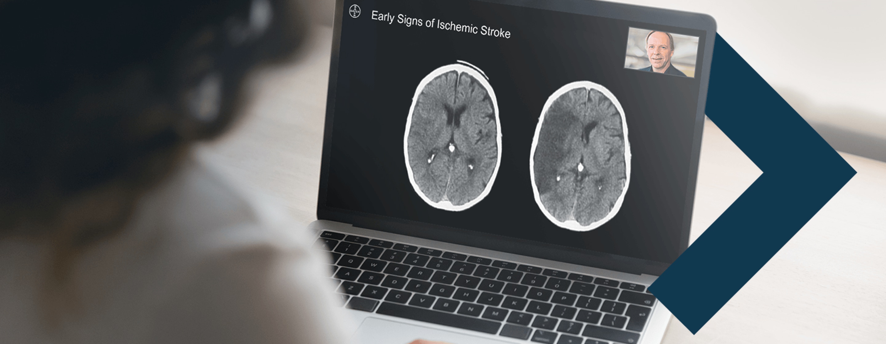 Laptop displaying a MicroLearning